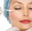 Blefaroplastika